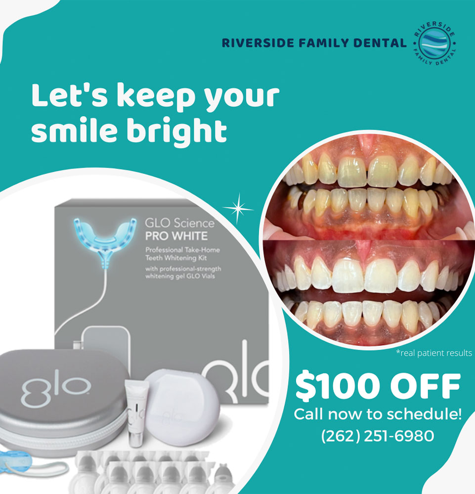 keep your smile bright promo graphic riverside blanchard